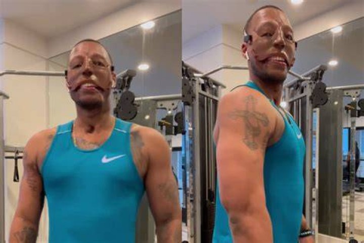 Unraveling the Mystery of Randy Adams' Face Accident